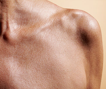 Visible Results On Targeted Areas