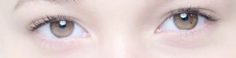 Caring For Sensitive Under-Eye Skin